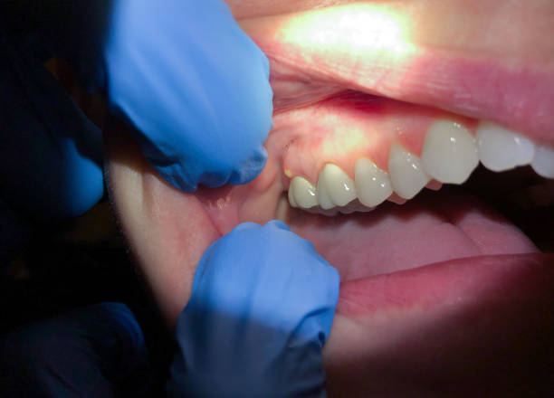 Best Emergency Dentist for Knocked-Out Tooth in Sierra Vista, AZ